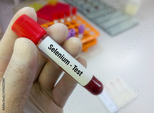 Blood sample for Selenium test