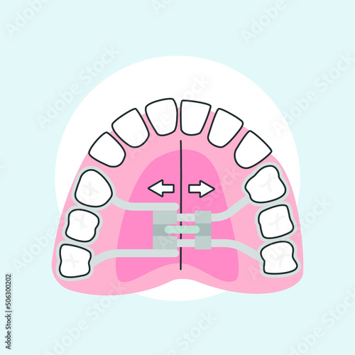 Ortodoncia Interceptiva Orthodontist vector illustrator