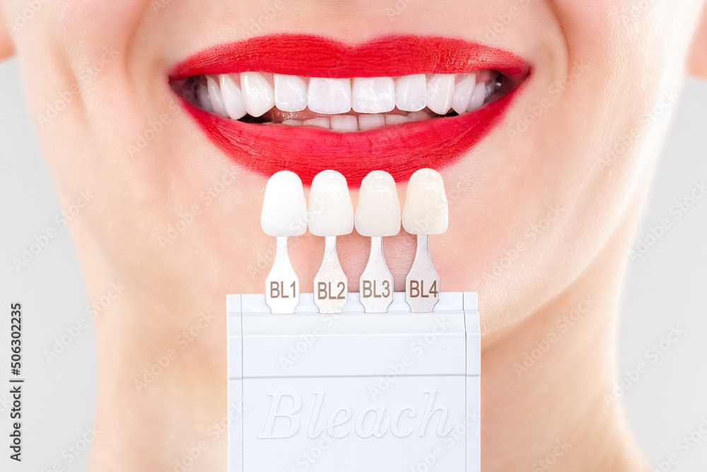Perfect white smile red lips with shade guide bleach color tooth dental