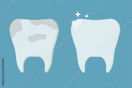 Healthy clean tooth and tooth with plaque. Template for stomatology or dentistry. Dental care Concept