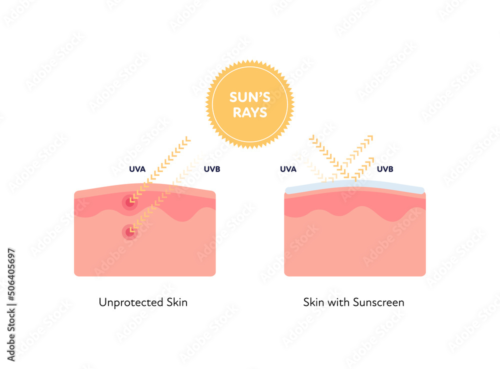 Uv rays and visible light healthcare infographic. Vector flat people ...