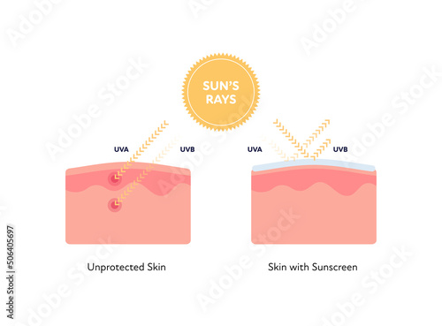 Uv rays and visible light healthcare infographic. Vector flat people illustration. UVA, UVB arrow penetarate unprotected and reflect from protected skin layers. Design for uv awareness month.