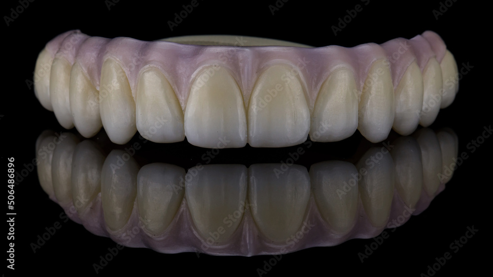 dental prosthesis of the upper jaw from zircon with pink gum on black glass with creative reflection dental prosthesis of the upper jaw from zircon with pink gum on black glass with creative reflection