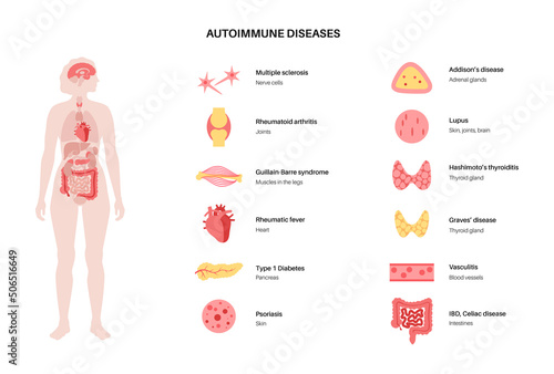 Autoimmune disorders diseases