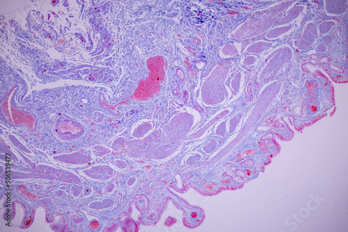 Columnar epithelium of human gall bladder under the microscope in Lab.