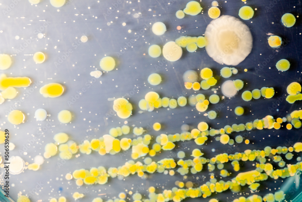Backgrounds of Characteristics and Different shaped Colony of Bacteria and Mold growing on agar plates from Soil samples for education in Microbiology laboratory. Backgrounds of Characteristics and Different shaped Colony of Bacteria and Mold growing on agar plates from Soil samples for education in Microbiology laboratory.
