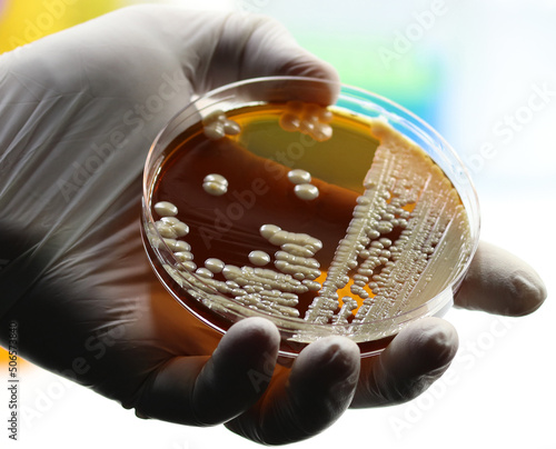 Bild auf Leinwand Hand of a researcher showing a close-up of a microbiological culture plate with