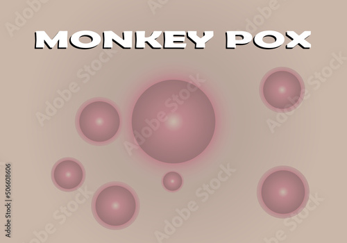 Viruela del mono. Fondo con pústulas de la viruela del mono sobre la piel acompañado de título de la enfermedad en inglés