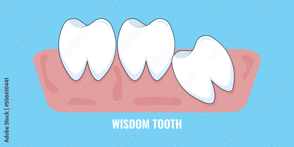 Wisdom tooth icon. Vector illustration. Dental care concept. Angry, surprised and annoyed kawai emoji Wisdom tooth icon. Vector illustration. Dental care concept. Angry, surprised and annoyed kawai emoji