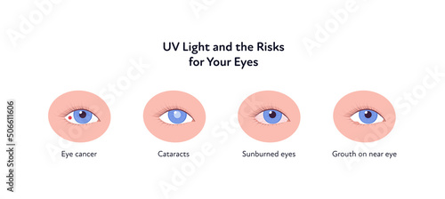 Summer uv sunscreen protection and eye diseave concept. Vector flat healthcare iillustration. Various eye disease symbol. Cancer, cataract, sunburn and grouth illness. photo