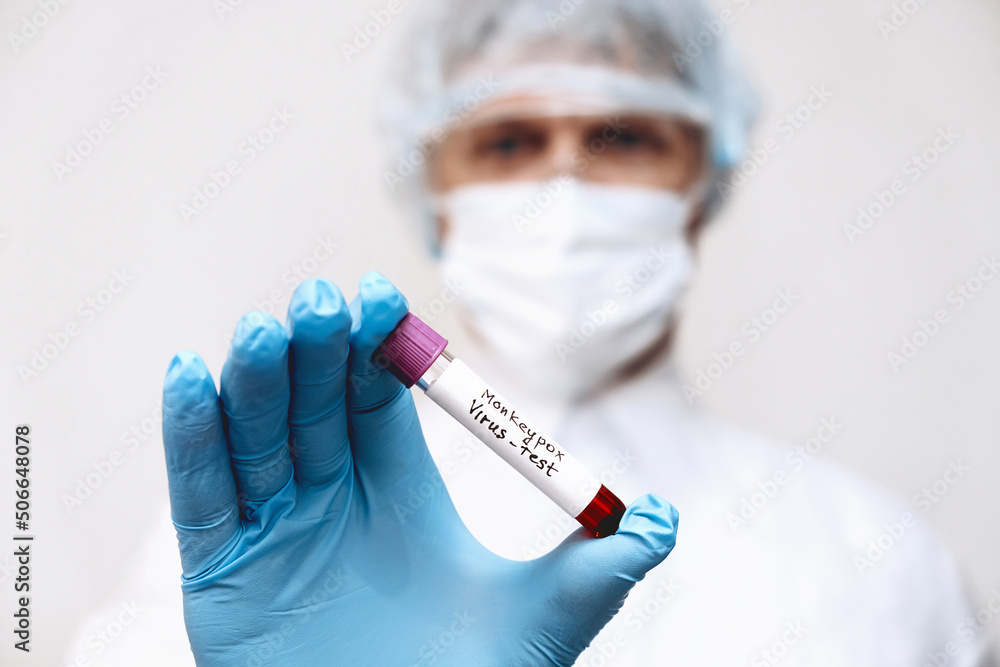 A medical worker holds a test tube with Monkeypox virus infected blood sample in his hands,hands in gloves close-up.Epidemic of smallpox monkeys in Europe and the USA. A medical worker holds a test tube with Monkeypox virus infected blood sample in his hands,hands in gloves close-up.Epidemic of smallpox monkeys in Europe and the USA.