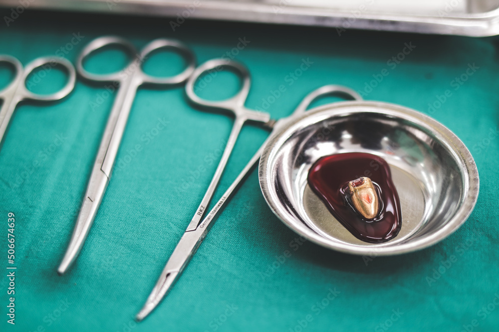 surgeon Remove the bullet from the patient's body in the operating room