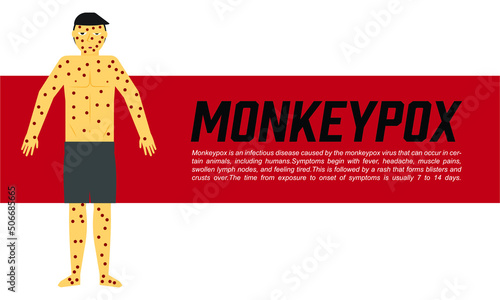 A vector of men with monkeypox illness  monkeypox word and the definition of the disease.