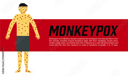A vector of men with monkeypox illness, monkeypox word and the definition of the disease.