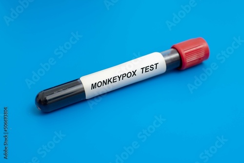 Blood sample tube for Monkeypox virus test.  Known as Moneypox virus photo