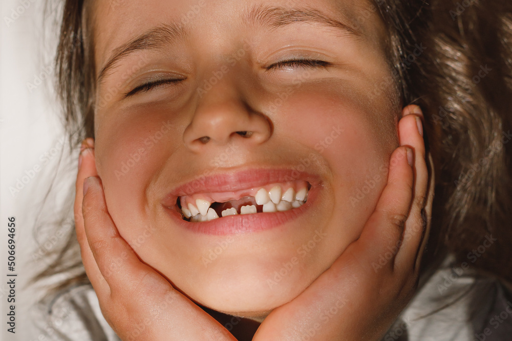 Portrait of a caucasian joyful schoolgirl with an open mouth without a milk tooth, close-up, sunny day Portrait of a caucasian joyful schoolgirl with an open mouth without a milk tooth, close-up, sunny day