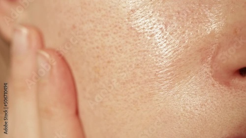 Unhealthy oily facial skin with enlarged pores and shiny sebum, texture part of the face. photo