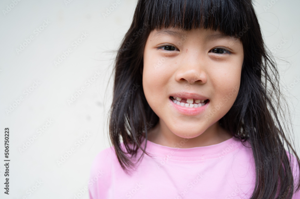 kid broken tooth, asian girl smiling kid broken tooth, asian girl smiling