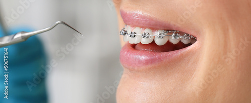 Woman with dental braces visiting dentist in clinic, closeup photo