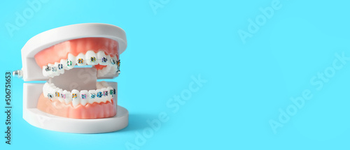 Schilderij op canvas Model of jaw with braces on blue background with space for text