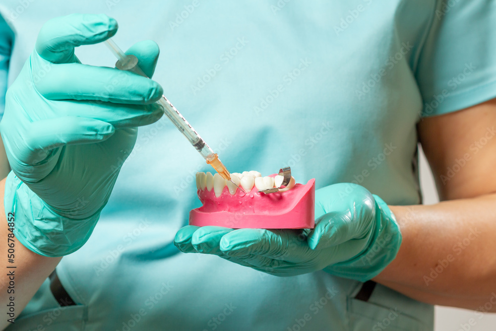 Dentist with layout of the human jaw and syringe. Stock Photo Adobe Stock
