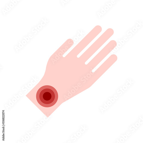 The icon of the hand and with the designation of pain. Carpal tunnel syndrome, arthritis, neurological disease concept. Numbness of the hand