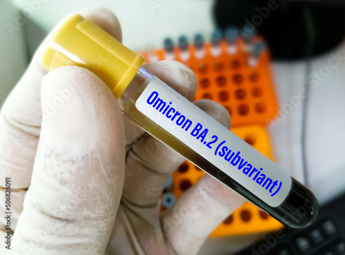 Blood sample for SARS-COV-2, Covid-19 Omicron Subvariant test at medical laboratory. BA.2 photo