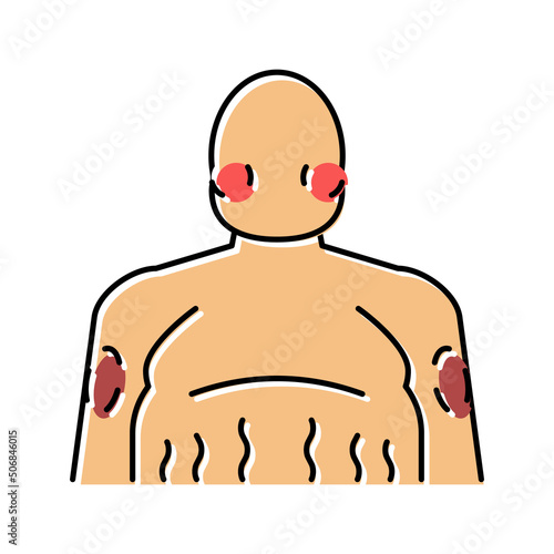 cushing disease endocrinology color icon vector illustration