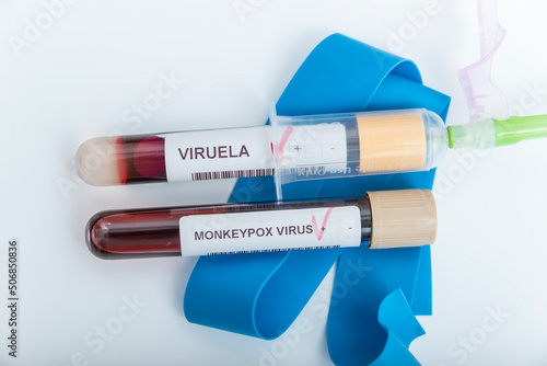 Blood sample tube for Monkeypox virus test. It is also known as the Moneypox virus. photo