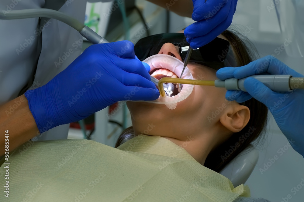 Dentist is preparing woman's teeth for installing ceramic veneers and crowns using drill. He is removing partly an enamel of the teeth. Dentistry, prosthetics concept. Treatment by an orthodontist. Dentist is preparing woman's teeth for installing ceramic veneers and crowns using drill. He is removing partly an enamel of the teeth. Dentistry, prosthetics concept. Treatment by an orthodontist.