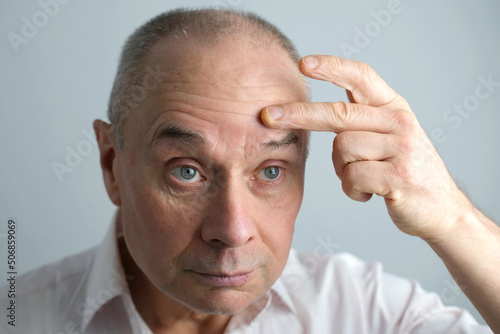 close-up of face of bald mature man 60 years old looks in mirror, critically examines face, skin, wrinkles, upset because age-related changes, midlife crisis, hair loss, selective focus