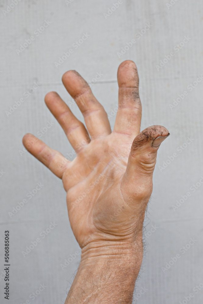 dry skin of the hand and fingers of a man with cracks and vitamin