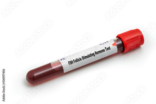 FSH Follicle Stimulating Hormone Test Medical check up test tube with biological sample photo