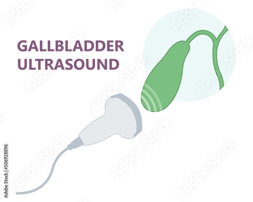 gallbladder cystic bile duct cancer pain drain polyps fine needle test and chole diagnose obstructive Acute tract stones