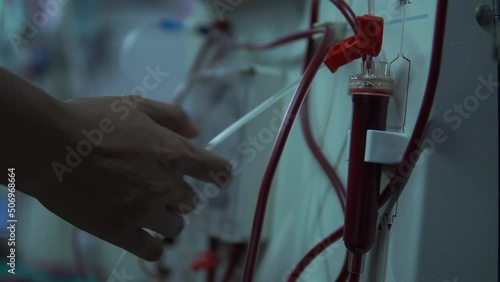 Close up doctor hand uses a dialysis machine for the patient