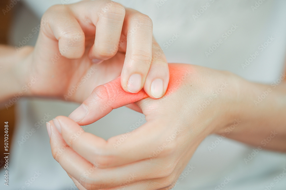 Finger pain woman due to various diseases related to bone Health care concept.
