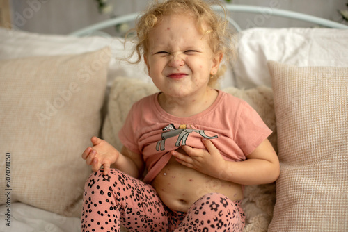 Little toddler girl with chicken pox in bed, playing at home, quarantine isolation photo