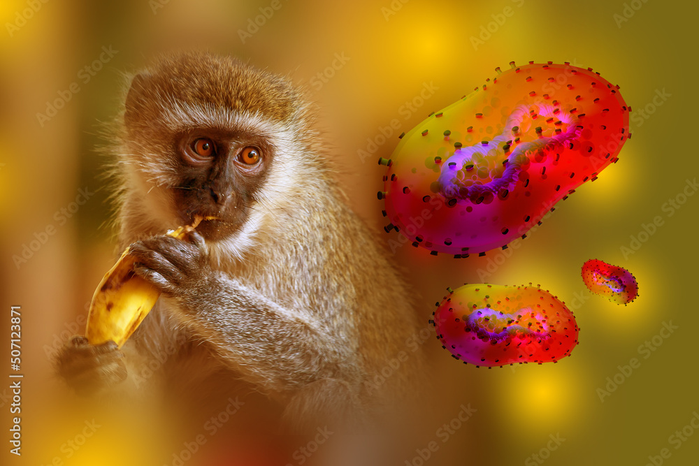 Monkeypox outbreak concept. Monkeypox is a viral zoonotic disease