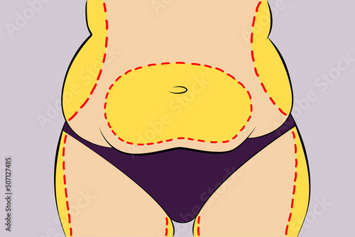 Woman fat belly with dotted line. Vector illustration. Weight and health problem concept.