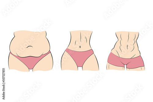 Different types of women body. Woman fat, skinny and muscle bodies. Transformation of body. Vector illustration.