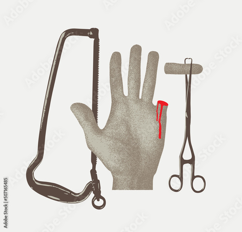 human hand with cut off finger on medical tweezers with blood and amputation saw