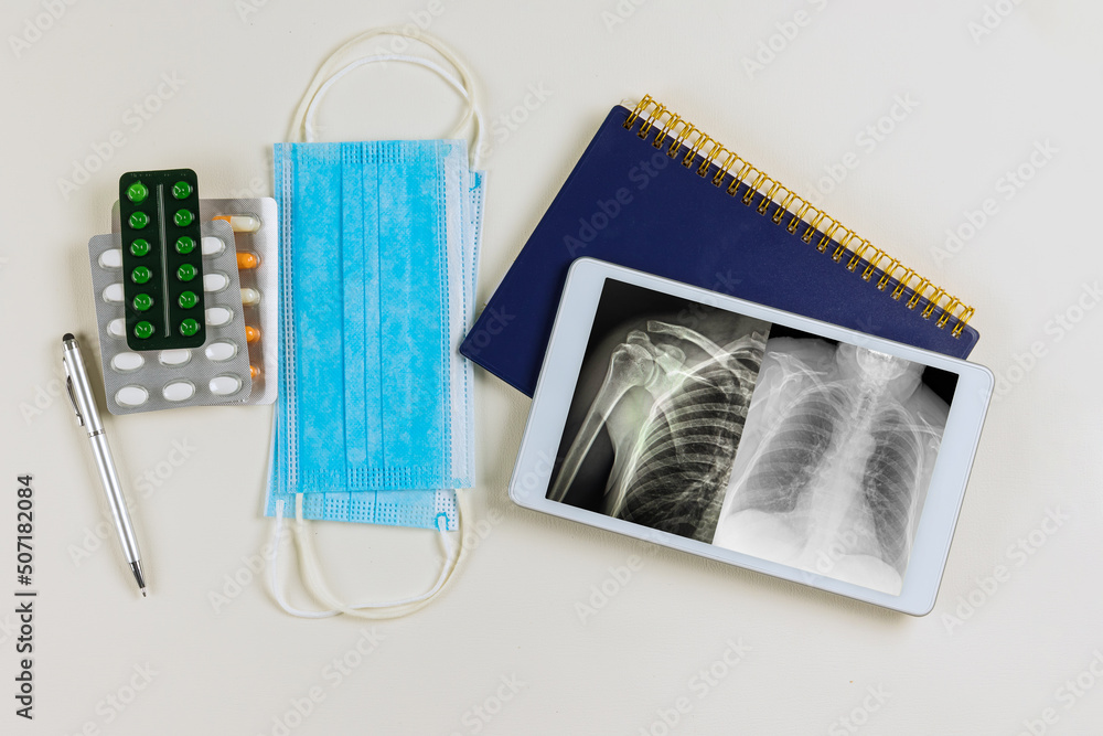 Doctor office desk table with using digital tablet computed radiography of left shoulder joint, antero-posterior Doctor office desk table with using digital tablet computed radiography of left shoulder joint, antero-posterior