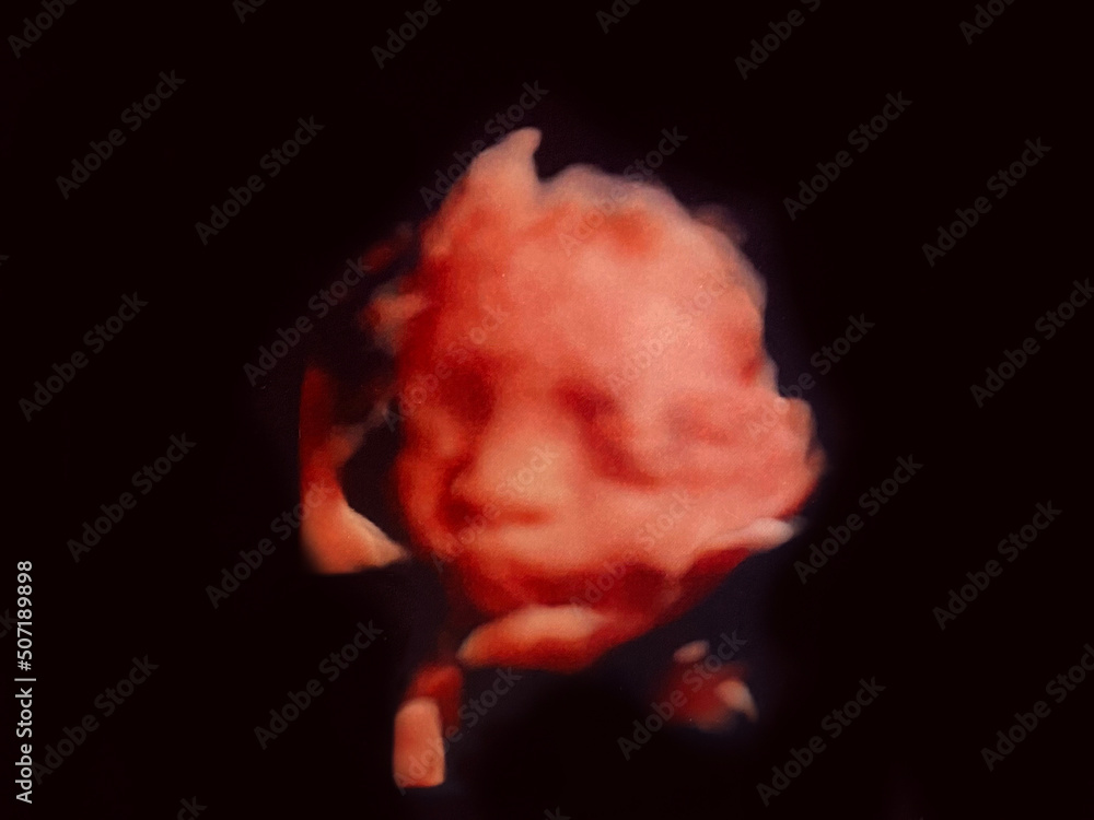 fetal baby ultrasound picture fetal baby ultrasound picture