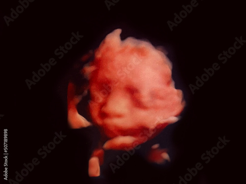 Obraz na plátně fetal baby ultrasound picture