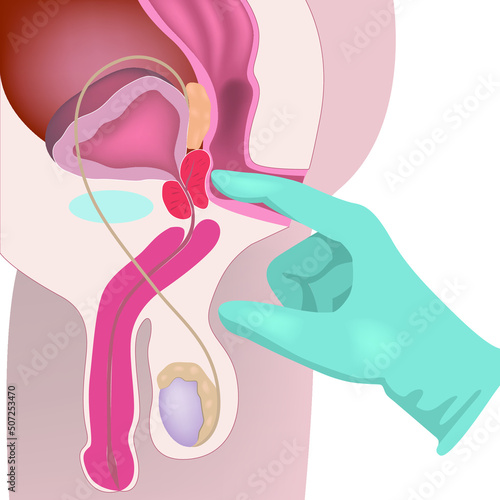 Reproductive system of a man. Palpation and massage of the prostate. Diagram with internal organs. Medical poster. Vector illustration