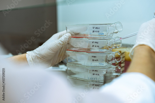 Scientist using a pipette to introduce medium in cell culture flasks photo