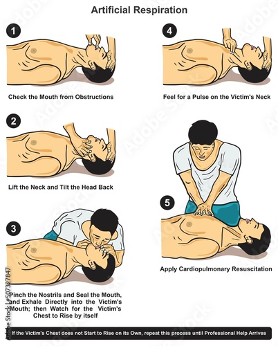Artificial respiration steps infographic diagram general medical public awareness lifesaving instruction information victim human body position  paramedic cartoon vector drawing illustration chart