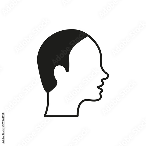 Bald Male Silhouette Icon. Hairless Man Black Pictogram. Alopecia Medical Problem Icon. Isolated Vector Illustration