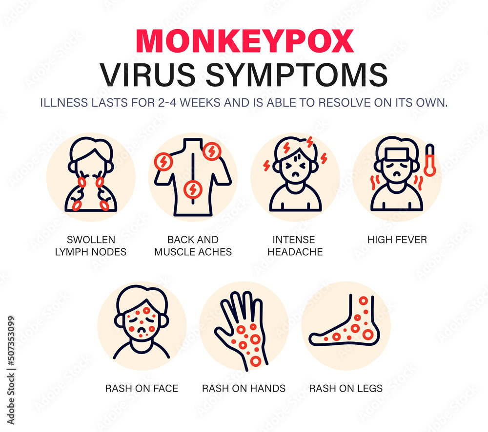 Monkeypox virus Symptoms icons. New cases of Monkeypox virus are reported in Europe and USA. Monkeypox is spreading in the Europe. It cause skin infections.