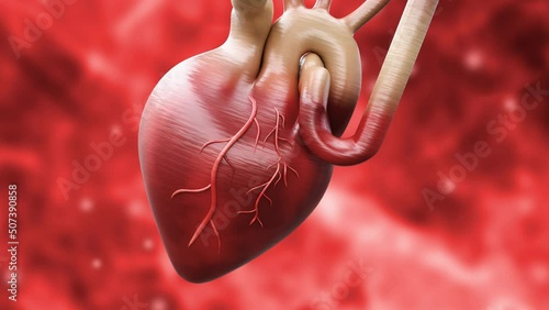 Heart attack or acute myocardial infarction occurs when a clot blocks blood flow to the heart photo